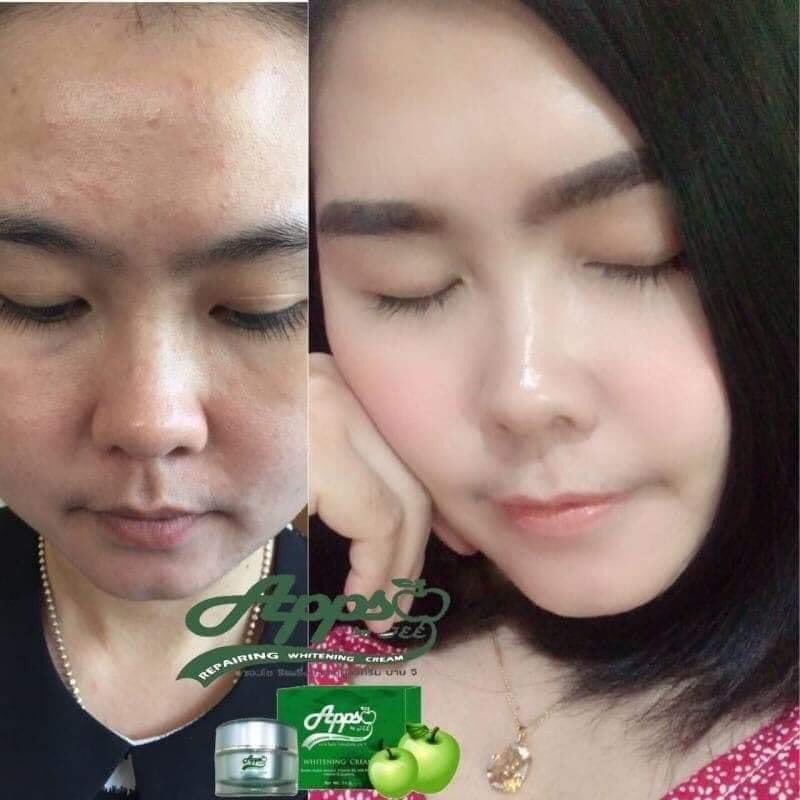 brRFTmB6Bu6mqqC's tweet photo. รีวิว ผิวหน้าดี๊ดี ใส๊ใส👉 #AppSo เลยค่ะ https://t.co/fb6aKkrDAc