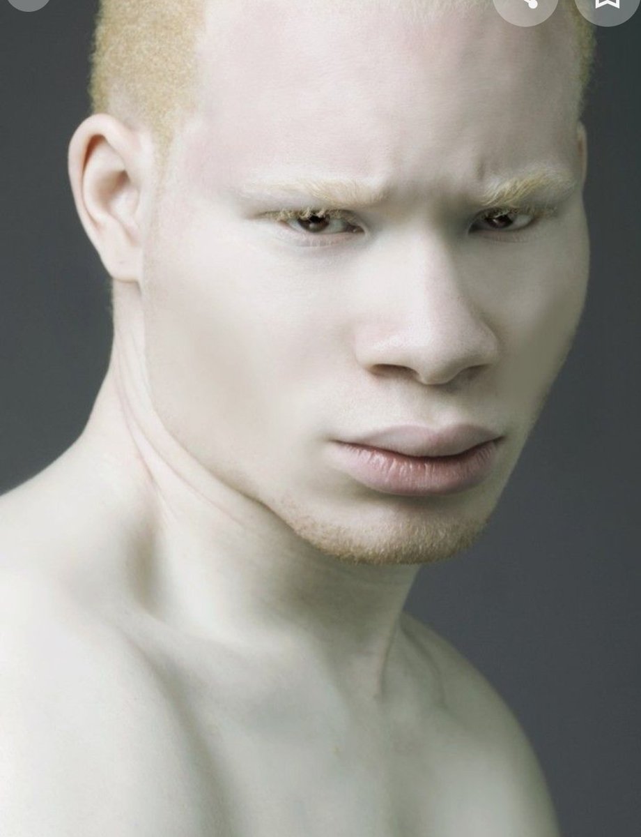 негр и азиат альбинос фото 119