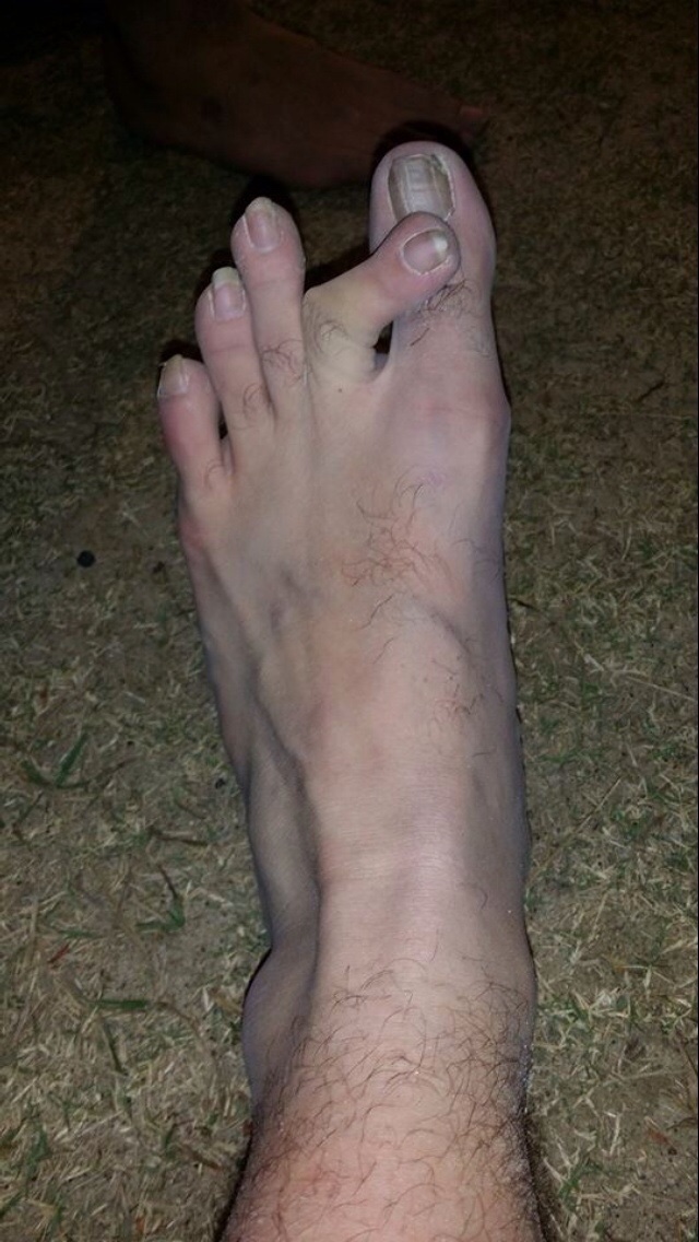 VergoFN's tweet photo. @dramasurge @lmgriffjohnson you like my feet? lmao https://t.co/TvPSHeyPyc