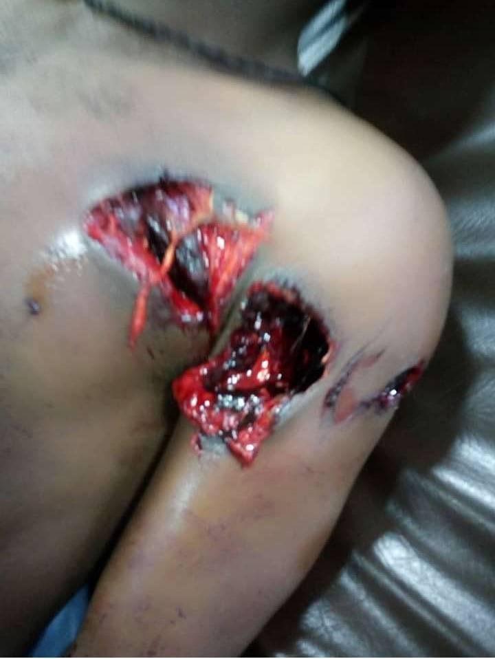 This is happening in Wolaita region of the so called-Ethiopia
Mass killing and detention by the government of the country