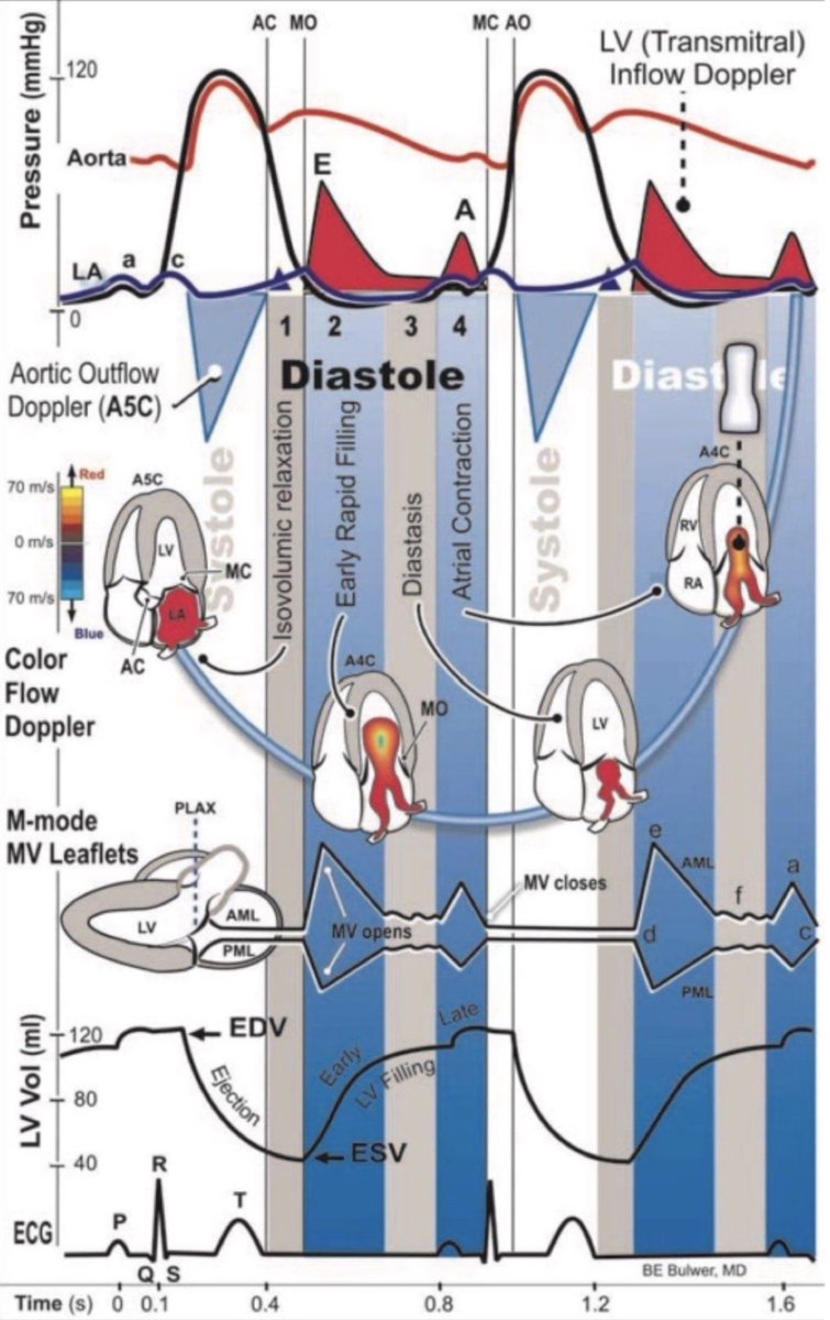 smexcardiologia's tweet photo. El corazón...la máquina perfecta. Excelente imagen para recordar los fenómenos eléctricos y mecánicos del ciclo cardíaco. ⚙️❤️

#SocMexCardio #BacktoBasics @rodrigogopar @mitrehit @LuisBaeza15 @GreciaRaymundo @drdargaray @aleglezl @daniieelg @MHMichel https://t.co/fXoIwMkyhg