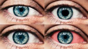 YOUR EYES... Notice how you are holding your phone in one hand? 30cm from your face?This reduced your ability to:1. See things accurately from a further distance (important for all athletic pursuits)2. Gives you BIAS towards 1 side (right side if holding phone in R hand