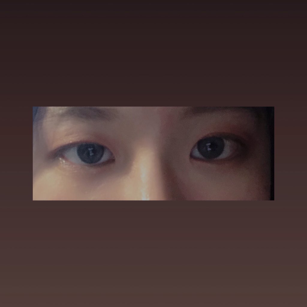 困鸟 眼睛睁不开鸟 为森么两只不一样 https://t.co/vYa2mywH6F