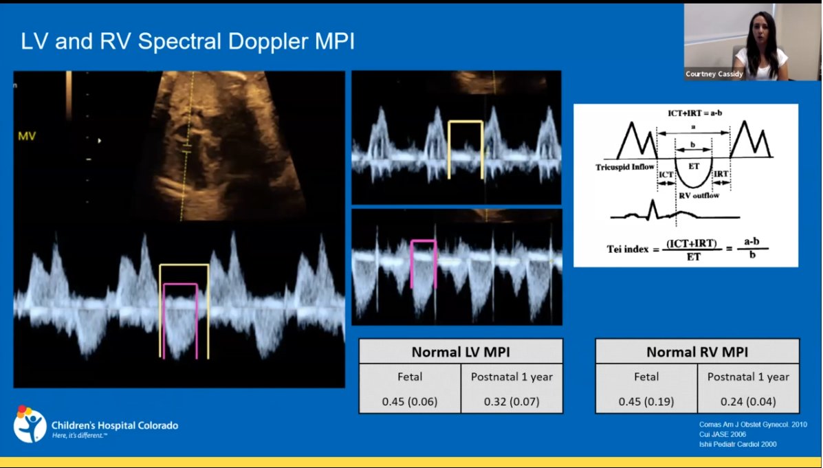 BonitaEcho's tweet photo. #BrianHaluskaSonographerResearchAwardCompetition – Courtney Cassidy’s @ccassidy03 research shows fetal growth restriction (FGR) evaluated by echo parameters (ncluding strain!); improvements in cardiac function noted by 3yrs.
#ASE2020 #VirtualEcho #EchoAtHome #EchoinPJs @ASE360 https://t.co/7W8L80kvKl