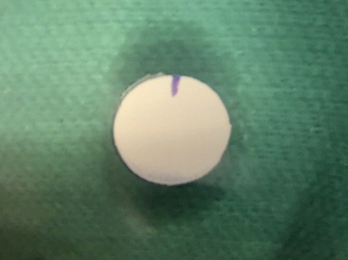 NuelleSportsMD's tweet photo. Listen to @rileywilliamsMD discuss fresh precut osteochondral allograft core technique &amp; his overall approach in this podcast: https://t.co/8Q3oos6Dik
#cartilage #restoration #Knee 
@HSSProfEd @TSAOG_Ortho @AANAORG @CartilageRepair @JRFOrtho https://t.co/fVRC9S90CU