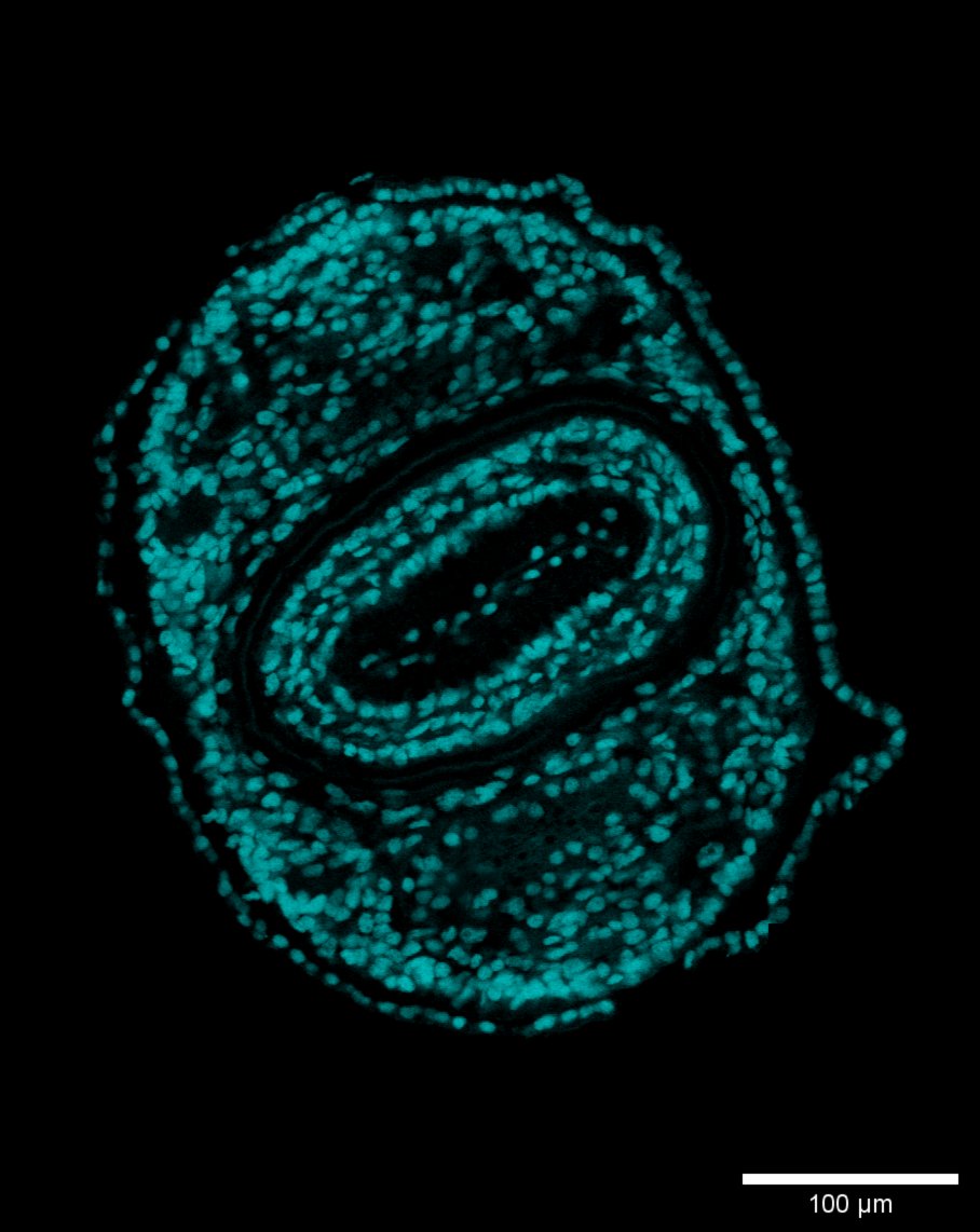 A planarian exhibits an extraordinary ability to regenerate lost body parts. Here I imaged a cross-section with a 2p microscope