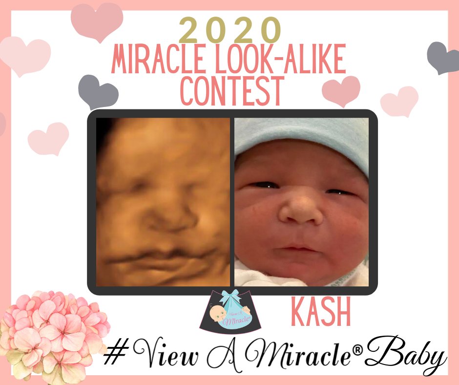 viewamiracle's tweet photo. Our 2020 MIRACLE LOOK-ALIKE CONTEST is spot on! #ViewAMiracleBaby https://t.co/WkOXWddyeA