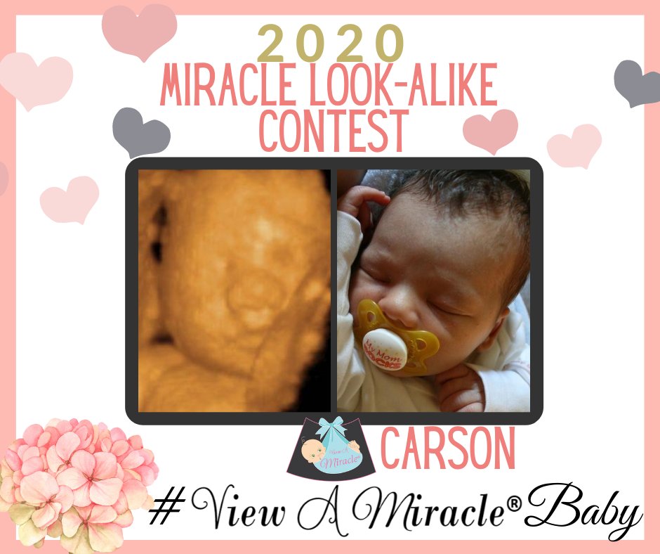 viewamiracle's tweet photo. Our 2020 MIRACLE LOOK-ALIKE CONTEST is spot on! #ViewAMiracleBaby https://t.co/WkOXWddyeA