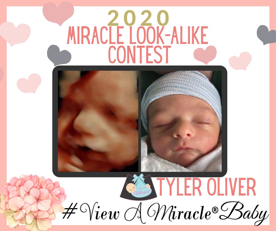 viewamiracle's tweet photo. Our 2020 MIRACLE LOOK-ALIKE CONTEST is spot on! #ViewAMiracleBaby https://t.co/WkOXWddyeA