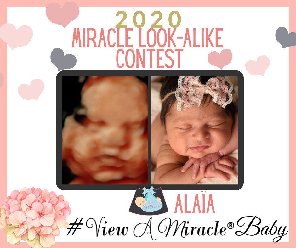 viewamiracle's tweet photo. Keep the #ViewAMiracleBaby photos rolling in! #BeforeandAfter #Ultrasounds https://t.co/AUG80NQpfx