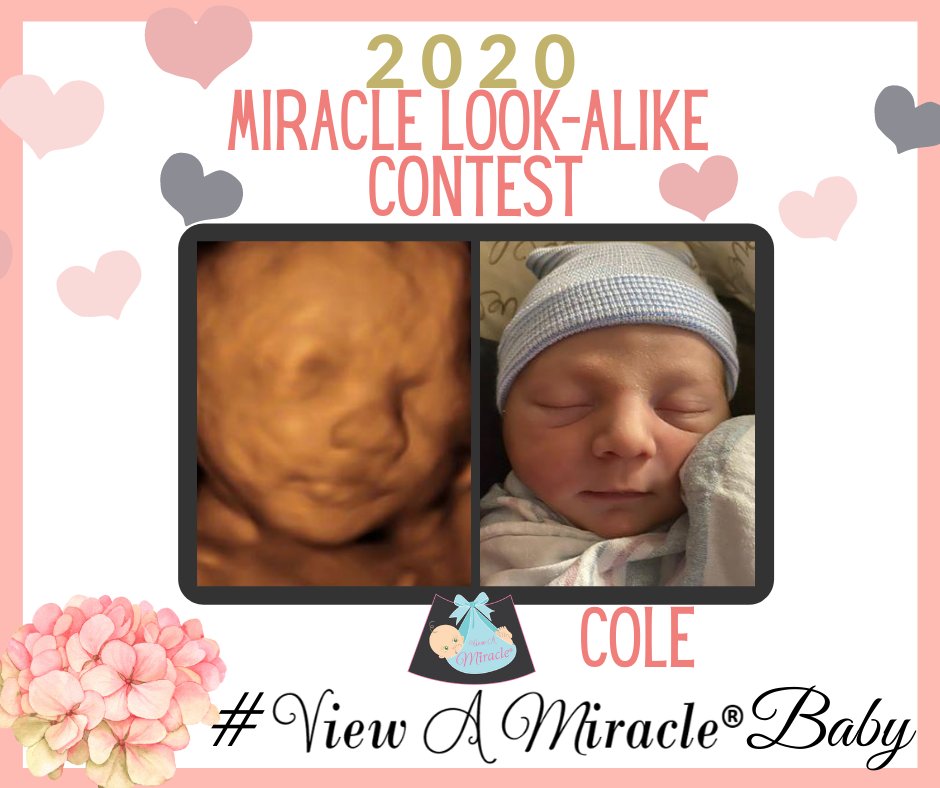 viewamiracle's tweet photo. Keep the #ViewAMiracleBaby photos rolling in! #BeforeandAfter #Ultrasounds https://t.co/AUG80NQpfx