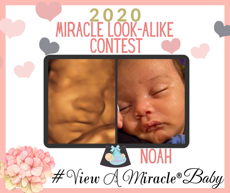 viewamiracle's tweet photo. Keep the #ViewAMiracleBaby photos rolling in! #BeforeandAfter #Ultrasounds https://t.co/AUG80NQpfx