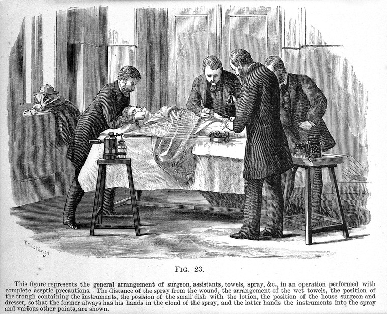 Joseph Lister performed the first antiseptic surgery on this date in 1865:  bit.ly/3fPgqpH
#HistMed #HistSurg #MedTwitter #MedStudentTwitter #medhum