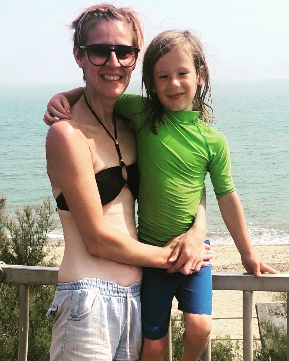 CarolineHarroe's tweet photo. This is a photo I didn’t think I’d https://t.co/nOIRnI1PQn took courage to wear a bikini.This should be a photo of joy with my boy but it’s dominated by anorexic thinking.I am sharing it to act against the #toofattohaveanorexia thoughts. #reclamation #bodyimage #justamum https://t.co/MEzNxVo9ID