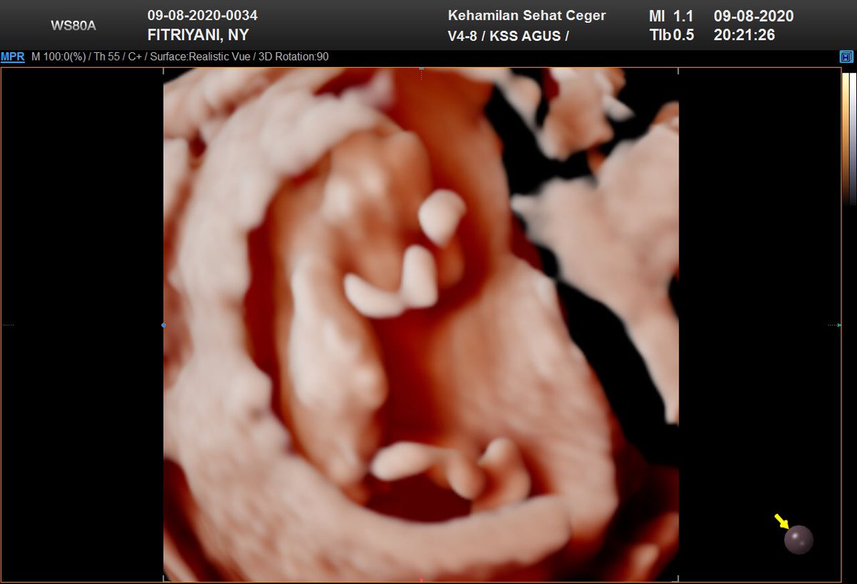 skandarfitt's tweet photo. #12weekspregnant, masya Allah tabarakallah ❤️ https://t.co/FWy6eWQpXy