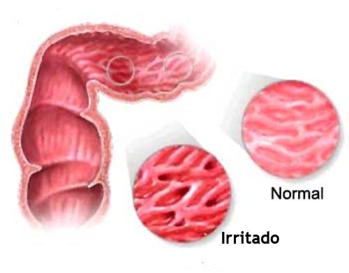 BColonIrritable's tweet photo. ✅4 Tips para calmar el #colonirritable.
➡️https://t.co/WuxpzCQa7E El dolor que causa este trastorno puede ser tan fuerte. Sigue estos 4 consejos que puedes realizar para aliviar los síntomas.via @mejorconsalud https://t.co/DZnA13yqGH