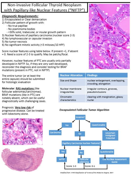 I just finished my Thyroid and Parathyroid Tumors section of "Kurt's Notes" (kurtsnotes.net), my teaching website.

Thyroid tumors: schaberg.faculty.ucdavis.edu/wp-content/upl…

#kurtsnotes #PathTwitter 

<a href="/Sara_Jiang/">Xiaoyin "Sara" Jiang, MD (She/Her)</a> <a href="/aakasharmand/">Zubair Baloch</a>  <a href="/SteveLongMD/">Steven Long, MD</a>