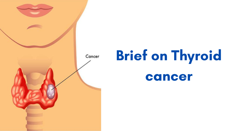 1stindianpharma's tweet photo. All about #thyroid cancer, its types, symptoms and its treatment.
#thyroidcancer #cancer #thyroidcare #thyroidcancertreatment
#cancercare #cancertreatment #cancermedication
Visit👇👇👇👇
https://t.co/UxjpHqFU7y https://t.co/8zspGcBuMP