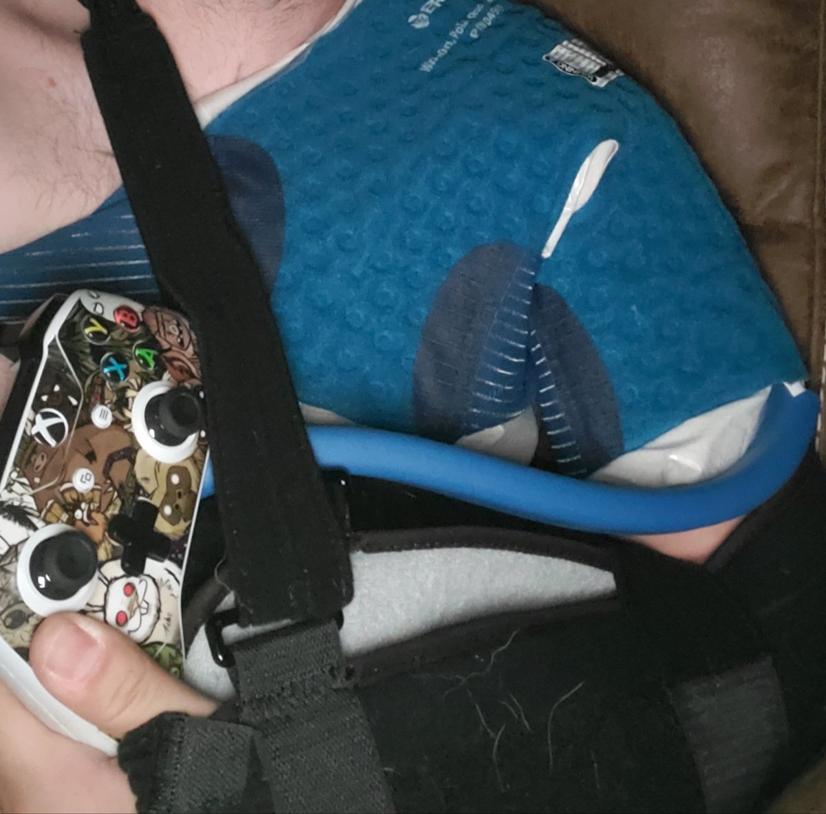 nutlug03's tweet image. One thing I can still do after shoulder surgery  is play #ProjectxCloud @xbox @klei @SeaOfThieves @RockstarGames I love having the ability to play my #XboxOne away from my console when needed