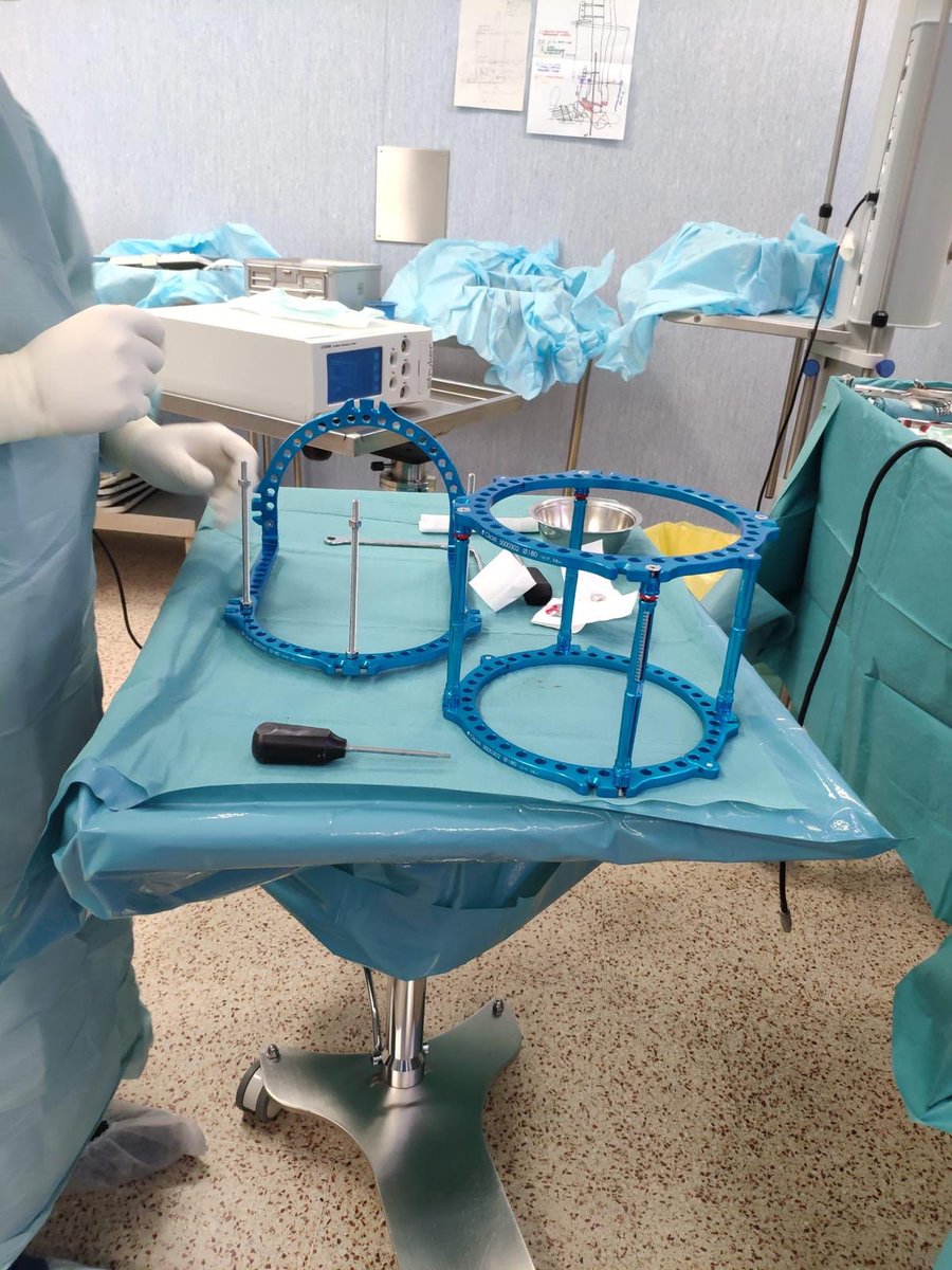 El Dr Rigol col.labora amb l’Hospital de Sta Caterina (Dr Madirolas) en el tractament d’un complexe cas de charcot de turmell amb fractura i osteomielitis prèvies. Artrodesi amb fixador extern (Mikai). Aprenem junts! <a href="/medcomtech_sa/">Medcom Tech</a> #diabetic #charcot #teamwork