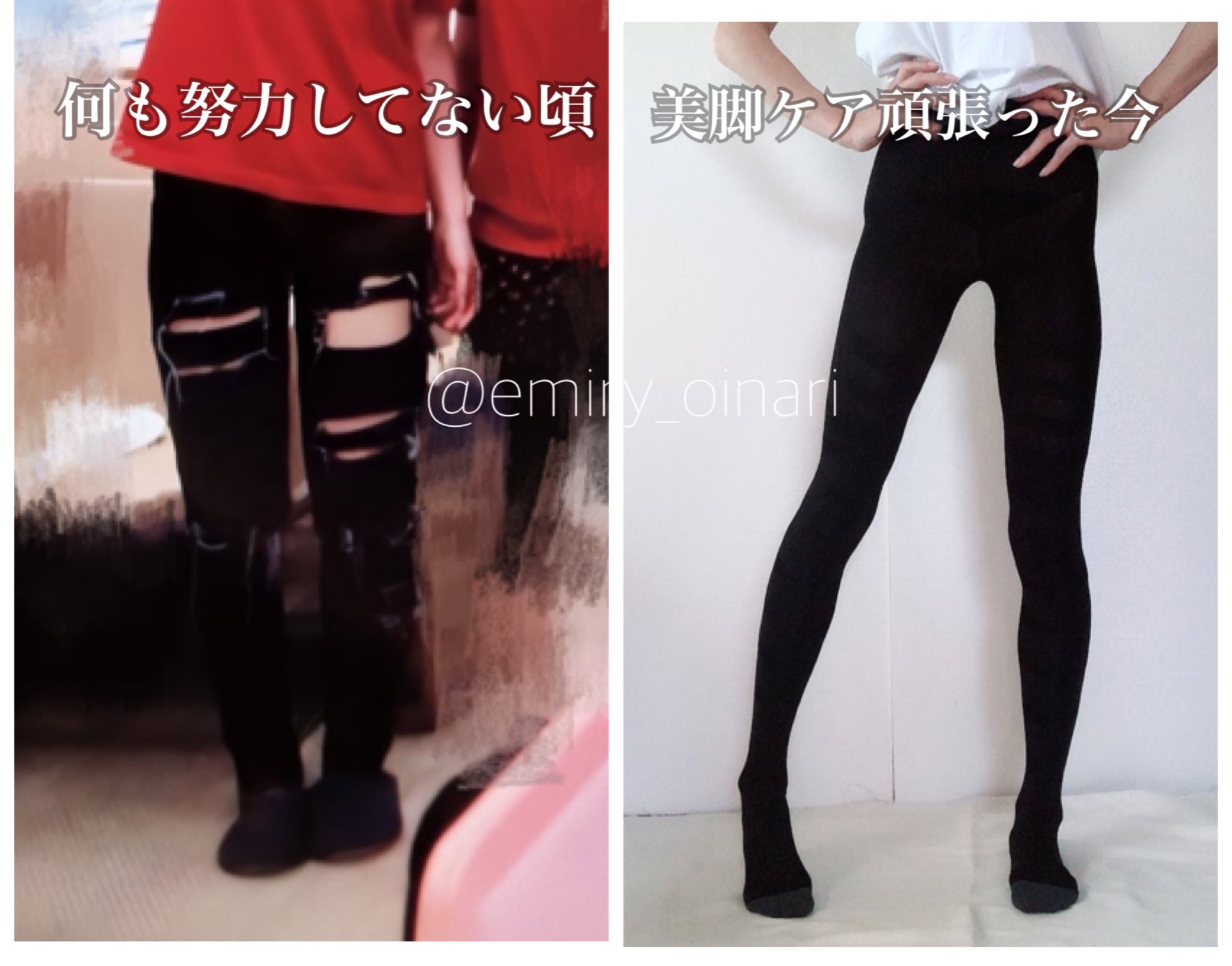 トレえみ Dmで メディキュットとの違い の質問が多かったのですが 元メディキュットを履いていた身からすると 1週間くらい穿き続けると全体的に伸びて着圧の効きが悪くなる そして履く時に指でズボッと破れやすいです グラマラとベルミスは伸びにくく トレえみ Dmで メディキュットとの違い の質問が多かったのですが 元メディキュットを履いていた身からすると 1週間くらい穿き続けると全体的に伸びて着圧の効きが悪くなる そして履く時に指でズボッと破れやすいです グラマラとベルミスは伸びにくく