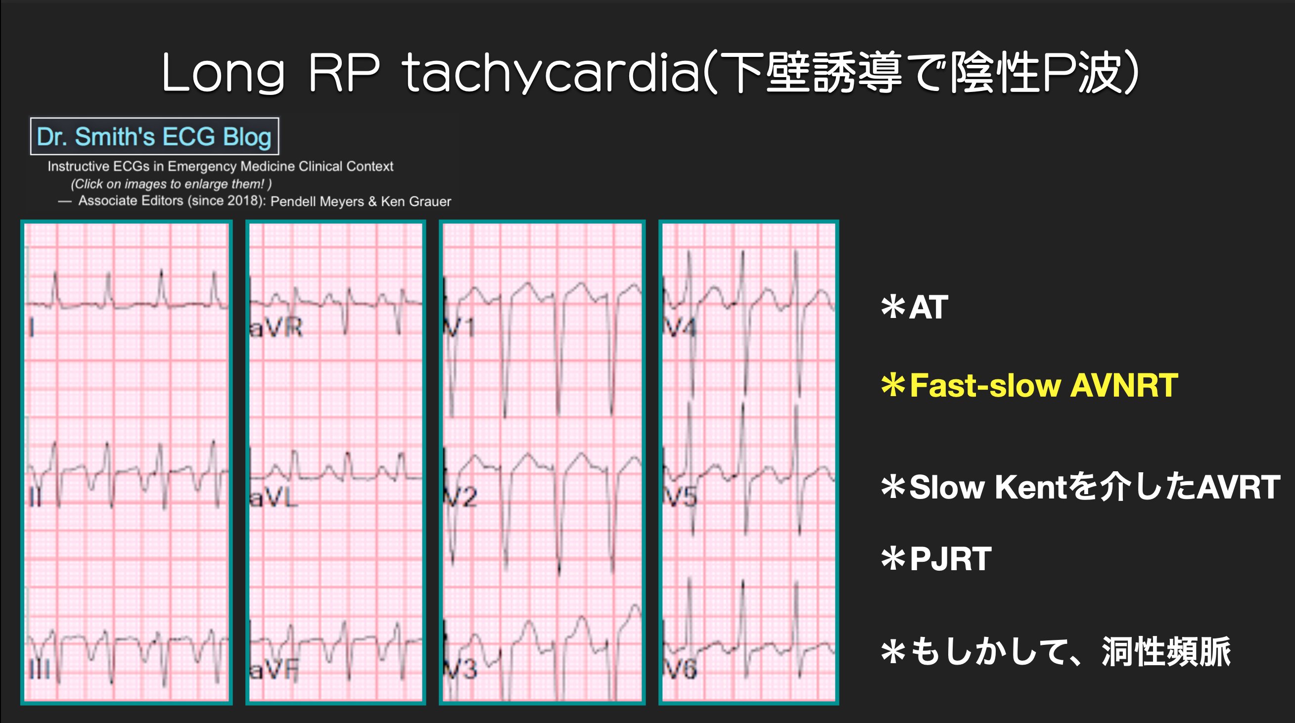 N. Tsukishima EP大学心電図検定学部試験対策科担任 on Twitter 