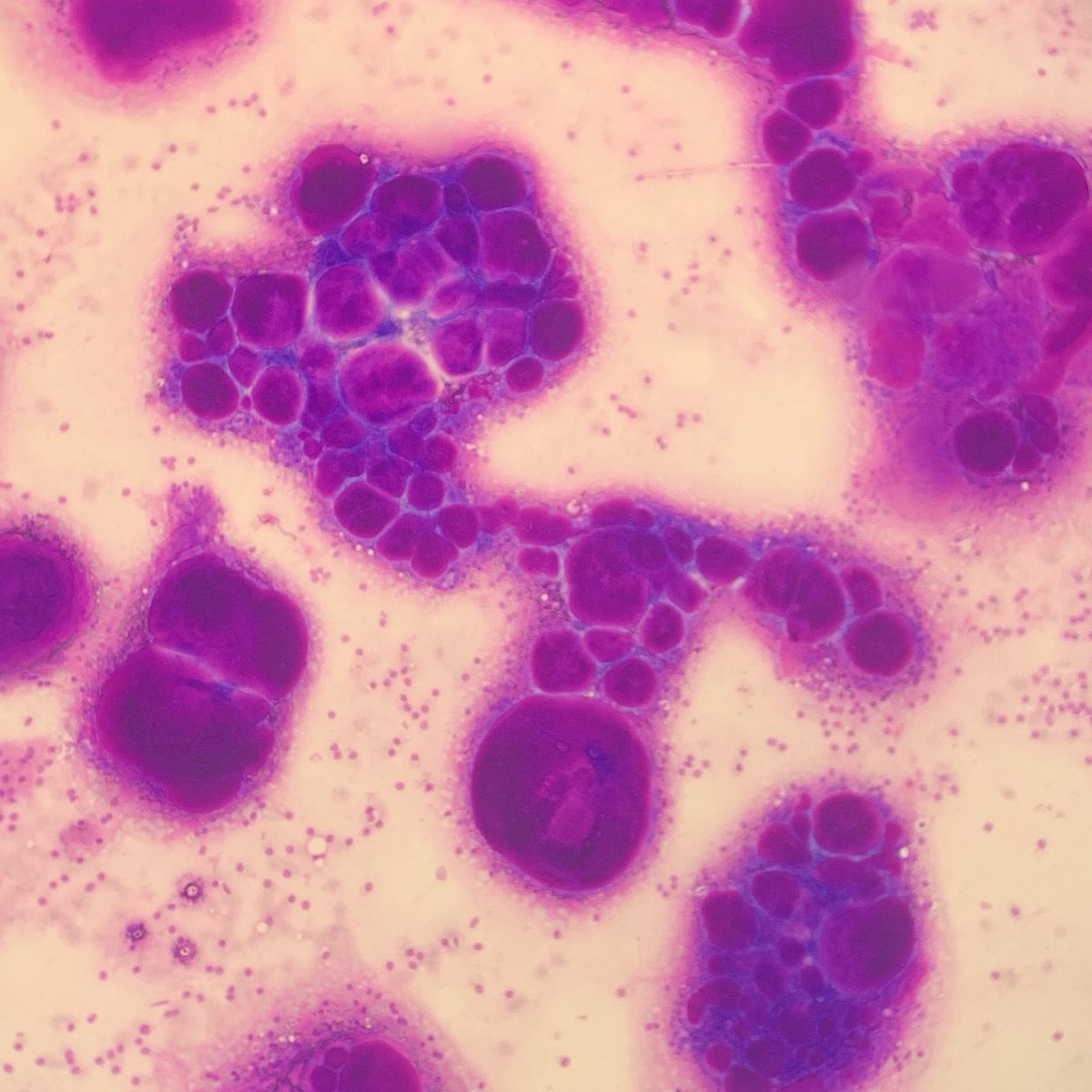 dmyers86's tweet photo. Salivary gland FNA. It doesn’t get any better than this. https://t.co/2ugo5u8JRe