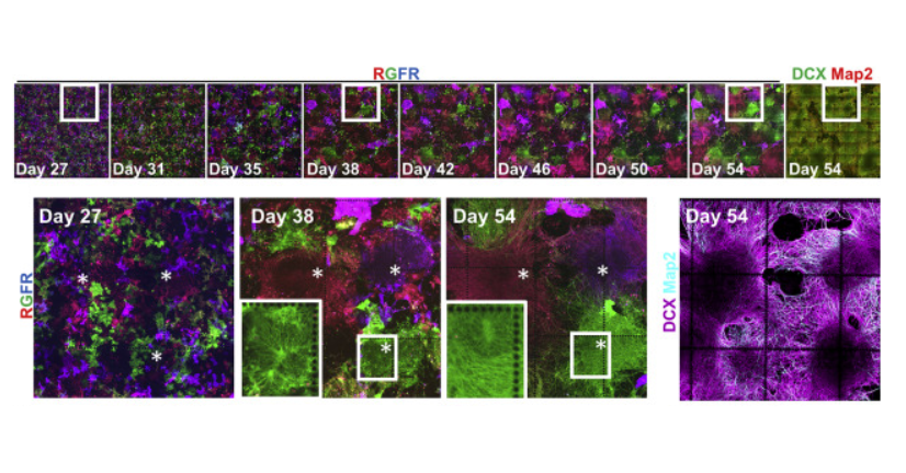 Science in Seattle (@science_seattle) on Twitter photo Using rainbow reporter technology, Danny El-Nachef (<a href="/delnachef/">Danny El-Nachef</a>) and colleagues from <a href="/UWISCRM/">ISCRM at UW</a> engineered human stem cells to validate approaches for tracking individual cells over time and down through generations.
📚Check out their fascinating study!
bit.ly/2PFORol Using rainbow reporter technology, Danny El-Nachef (<a href="/delnachef/">Danny El-Nachef</a>) and colleagues from <a href="/UWISCRM/">ISCRM at UW</a> engineered human stem cells to validate approaches for tracking individual cells over time and down through generations.
📚Check out their fascinating study!
bit.ly/2PFORol