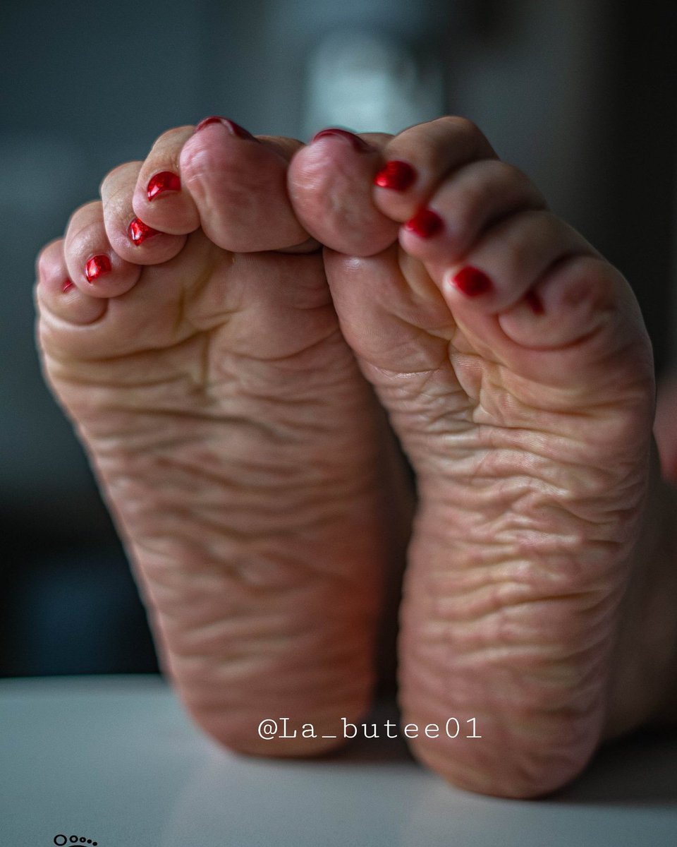 Wrinkled feet pics