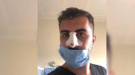 Ağrı Doğubayazıt Devlet Hastanesi’nde görev yapan bir çalışma arkadaşımız dün saldırıya uğradı. Saldırı, COVID-19 şüphesiyle teste gönderilen hastayla yakınına SOSYAL MESAFEYE UYMALARI UYARISI üzerine gerçekleşti. Sağlık çalışanları her türlü fedakârlığa hazır. Ama buna değil.