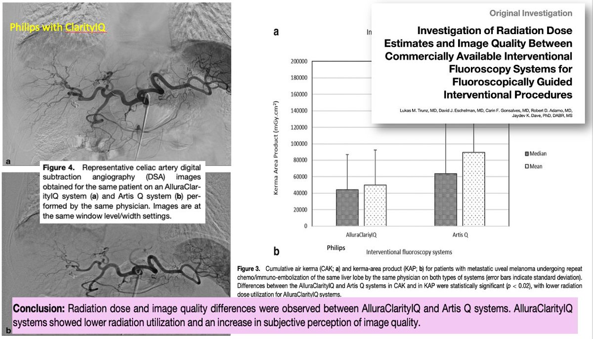 AtulGupta_MD's tweet photo. Interesting head-to-head study in Academic Radiology: proving you CAN have improved interventional image quality WITH much lower radiation dose. Paper by @carin_gonsalves and rad physicists at Jefferson @TJUHospital.
#Azurion #ClarityIQ @PhilipsHealth https://t.co/NqkpGT6vz0 https://t.co/6lGB7qeRs7