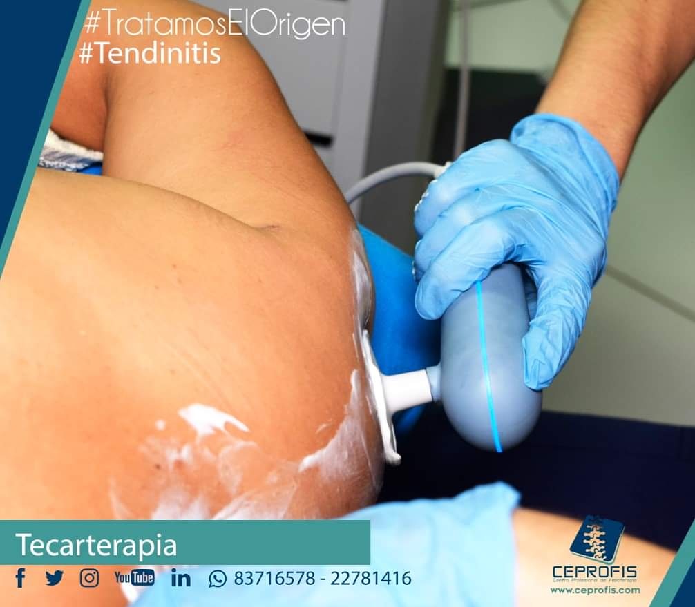 CE_PRO_FIS's tweet photo. 🤔#No #te #lo #puedes #perder🤔
🤭Ante una #Tendinitis,
😳conoce el #tratamiento y la #recuperación efectiva.
#Tecarterapia #Tratamiento #RadioFrecuencia
#Reserva en este momento !
#Managua 22781416 - 23195632
#ceprofis https://t.co/UV11Dw3c3i