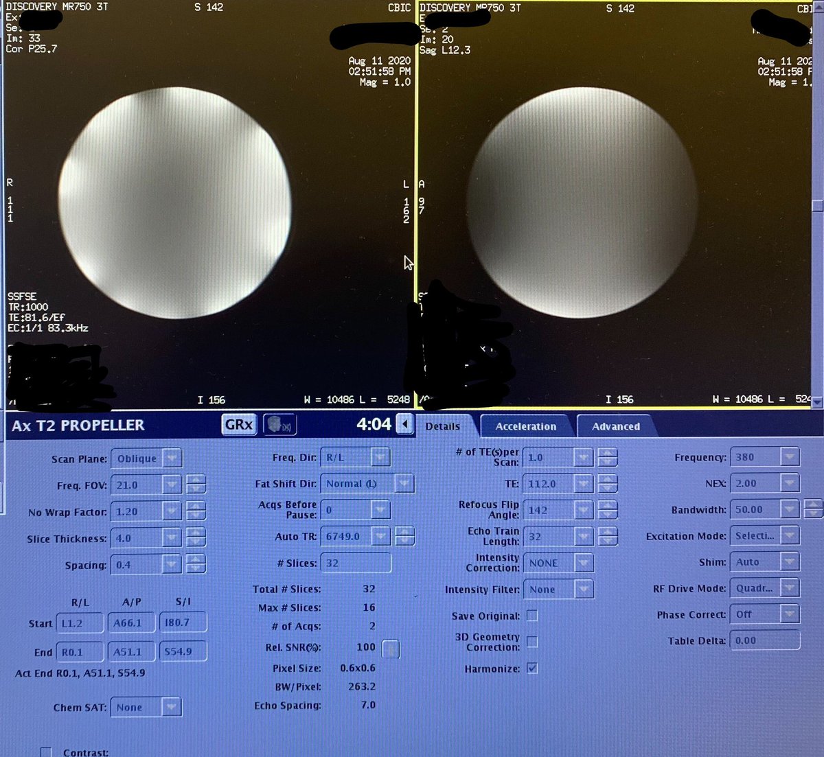 WinklerLabs's tweet photo. It's finally here! The lab's first MR image, and with a homegrown coil! Great job @isabellesan1 !! https://t.co/1XrXR5q2zQ