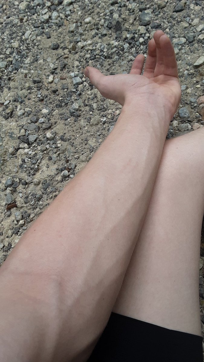 Nuclear_Narwhale tweet media