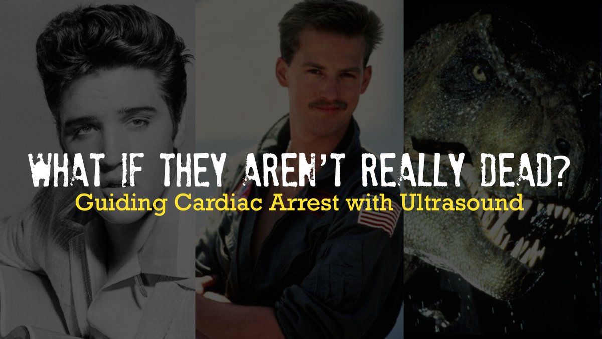 PhilipsPOCUS's tweet photo. What consequences come with chest compressions on a beating heart? Find out in this upcoming webinar, where @christifulli88 will show how ultrasound has changed the way we approach cardiac arrest and much more. Join us on 08/20, 3pm EST. 
Sign up now: https://t.co/DwAXMukC2Y. https://t.co/X3Jw6OXjr8