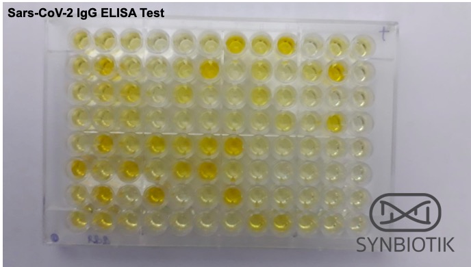 Sars-CoV-2 IgG / IgM ELISA kitlerimiz bir yandan akademik çalışmalara katkı veriyor. Kitlerimizde kullandığımız tüm antijenleri, biz tasarladık ve rekombinant olarak kendimiz üretiyoruz.