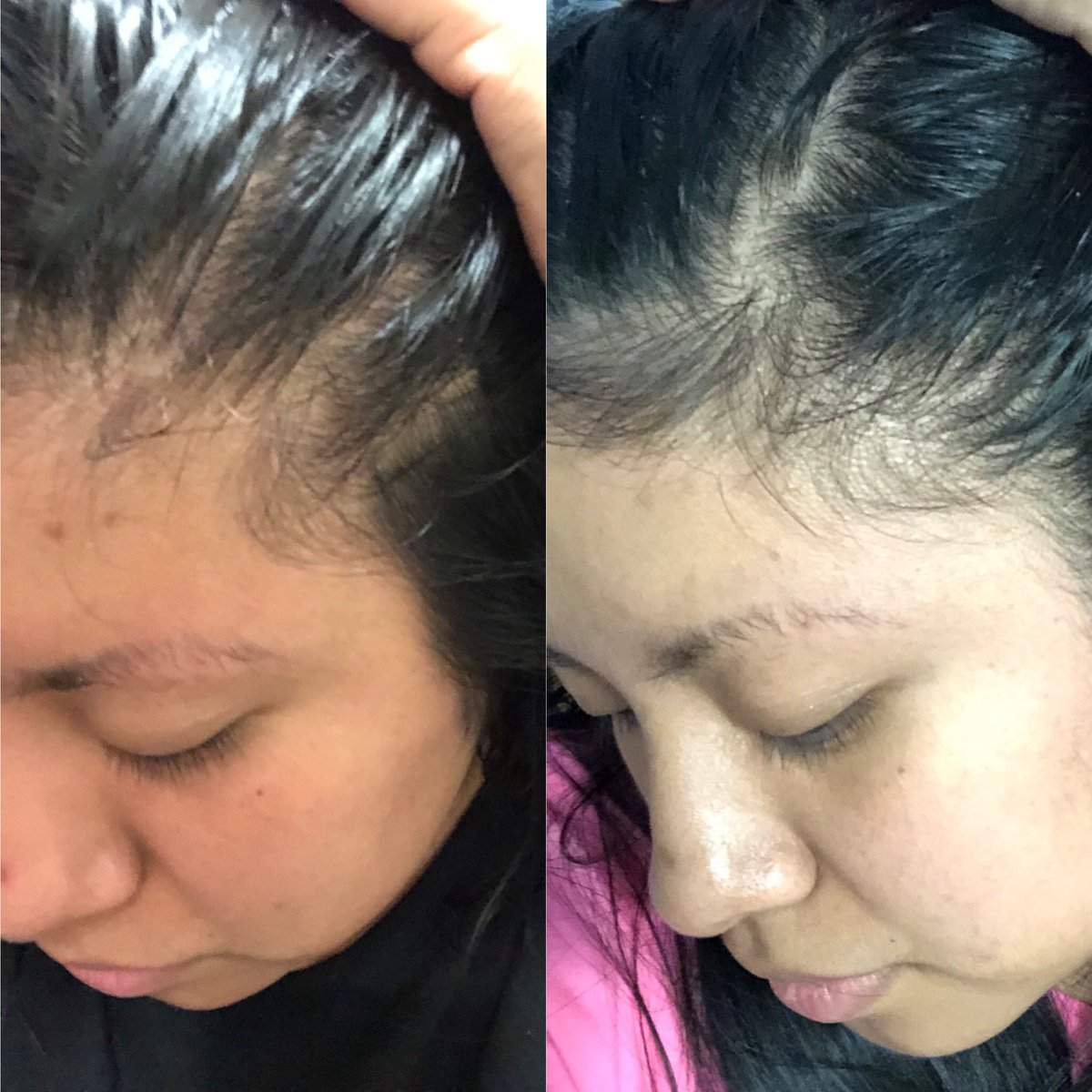 Check out my recent review on Pureauty Naturals’ Biotin Hair Serum!
Powered by BrandBacker!

instagram.com/p/CDw0BWcJqSZ/

Get yours at pureautynaturals.com

#sponsored #MyBiotin #BeautifulHair #HairforDays #ad