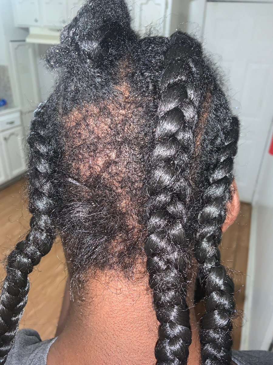 LesterDuhe's tweet photo. A 17 year old host at Chili’s in Baton Rouge was allegedly attacked by a group of 11 or more women Sunday, for enforcing the restaurants social distancing guidelines. Sending her to hospital w/ stitches. Her story &amp; a response from Chili’s on @WAFB at 10. https://t.co/liZ0iDBW6n https://t.co/RQfosFCaUu