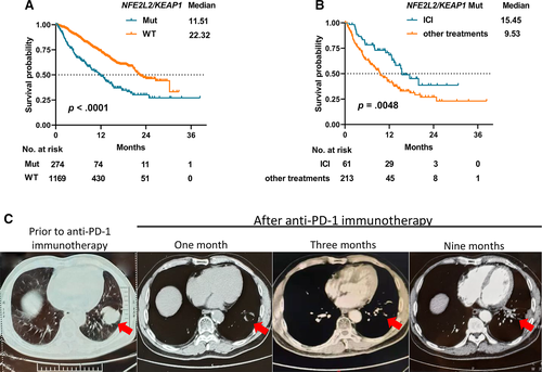 OncJournal's tweet photo. NFE2L2/KEAP1 Mutations Correlate with Higher Tumor Mutational Burden Value/PDโL1 Expression and Potentiate Improved Clinical Outcome with Immunotherapy
#NFE2L2 #KEAP1 #TMB #Immunotherapy
https://t.co/OYIV17DomS https://t.co/JCbCGK9Ivm
