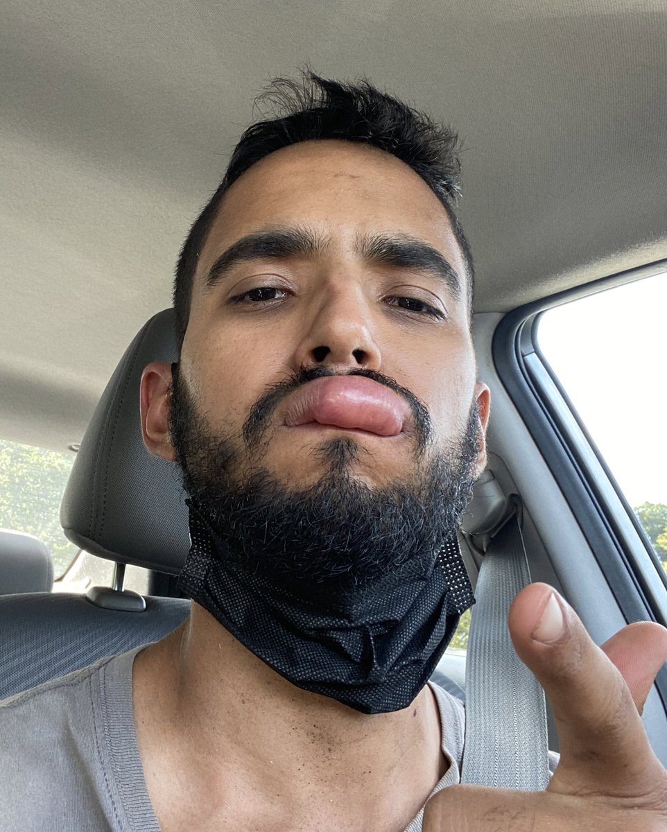 matheusgg___'s tweet photo. Definition of “Shit happens”
🤪🙃
Minha missão agora é exterminar todas as abelhas que eu encontrar
#PaybackBitch https://t.co/uArToeWMjL