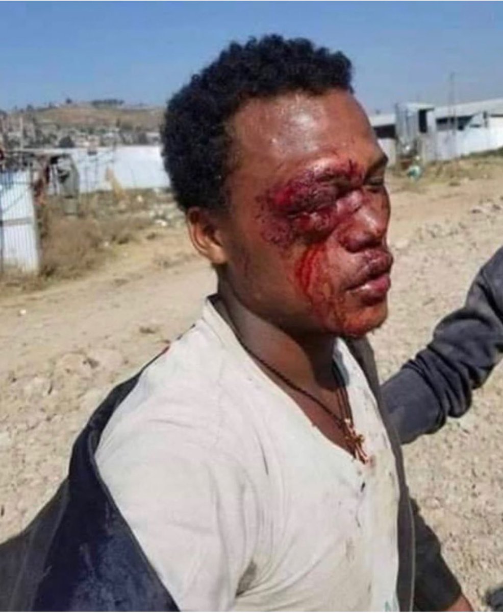 A THREAD ON WHAT IS HAPPENING IN ETHIOPIA RIGHT NOW!! PLEASE SHARE, RETWEET OR ANYTHING YOU CAN they need our help! give this the same energy you gave lebanon PLEASE!!  #PRAYFORETHIOPIA