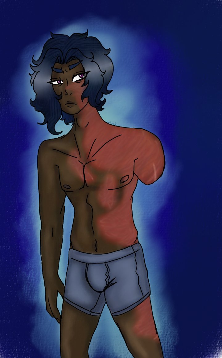 Vitriola1's tweet photo. #digitalart #oc #LeytonLJones #amputeeoc #burnedoc 
Oh hey, it's Leyton. https://t.co/oAc6tglOvI