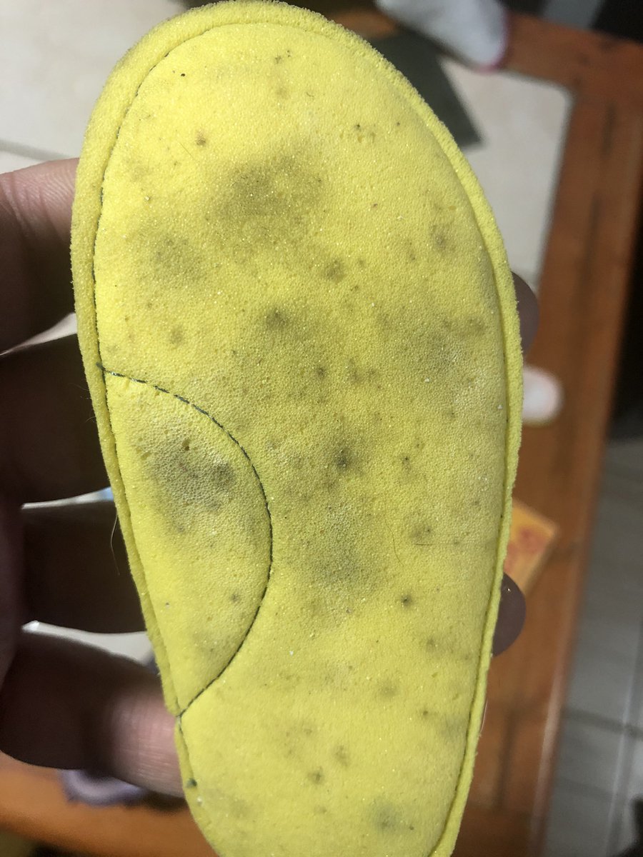 seba160884's tweet photo. Pésima calidad de zapatillas, teniendo 2 meses de la compra, con muy poco uso, se les crearon hongos en su interior si estar expuestas a humedad @BbgChile https://t.co/UcLx0Ppm3k