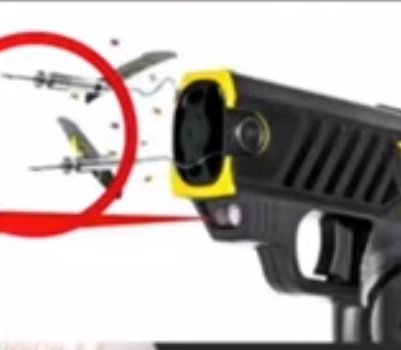 dishu2905's tweet photo. ⚠️⚠️🛑🛑
today i saw the post about stun guns and hw they r used ! also wat mark do they leave ! the exact mark❗
guyzz they really used stun guns to paralyse him ! 
#ArrestRhea 
#adityathackeray 
Retweet 🙌 #JusticeForSushantSinghRajput #SiddharthPithani #ArrestRheaChakroborty https://t.co/jcXn6F6gzK