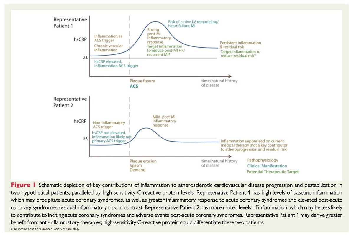 ESC_Journals's tweet image. Targeting #cardiovascular inflammation: next steps in clinical translation bit.ly/3ad1ReC

@escardio #EHJ #ESC_Young #cardiotwitter @ehj_ed