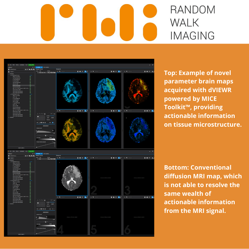 _R_W_I's tweet photo. We are very excited to announce the launch of dVIEWR Powered by MICE Toolkit™, our first commercial software product designed for clinical researchers and radiologists.

Come chat to us about it in our Virtual Booth at #ISMRM2020 - we're there 12-2 pm CEST! https://t.co/fhHAfV4gEt