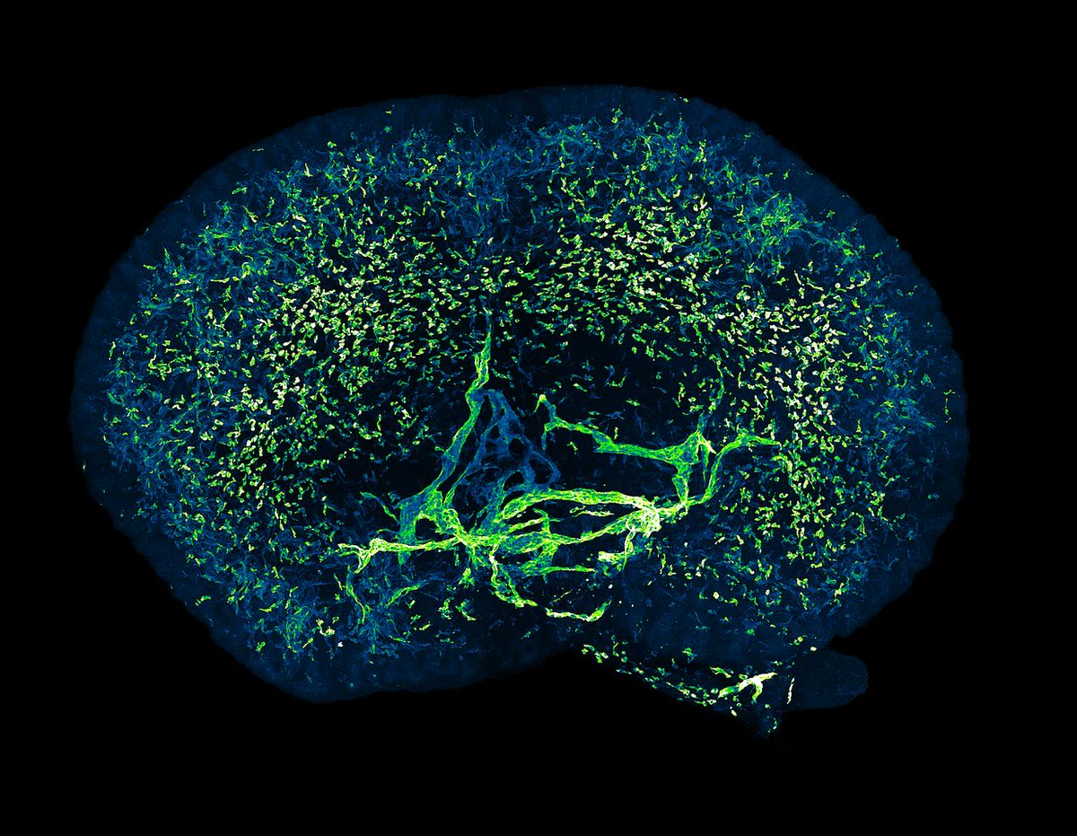 UCL_ICH_Kidney's tweet photo. Excited to share the news that @ICH_Nephro researcher David Long has been awarded a prestigious @wellcometrust investigator award to examine #lymphatics in #kidney health and disease. Cumulation of the fantastic work all the students and post-docs have been doing over many years. https://t.co/eji86BiVwh