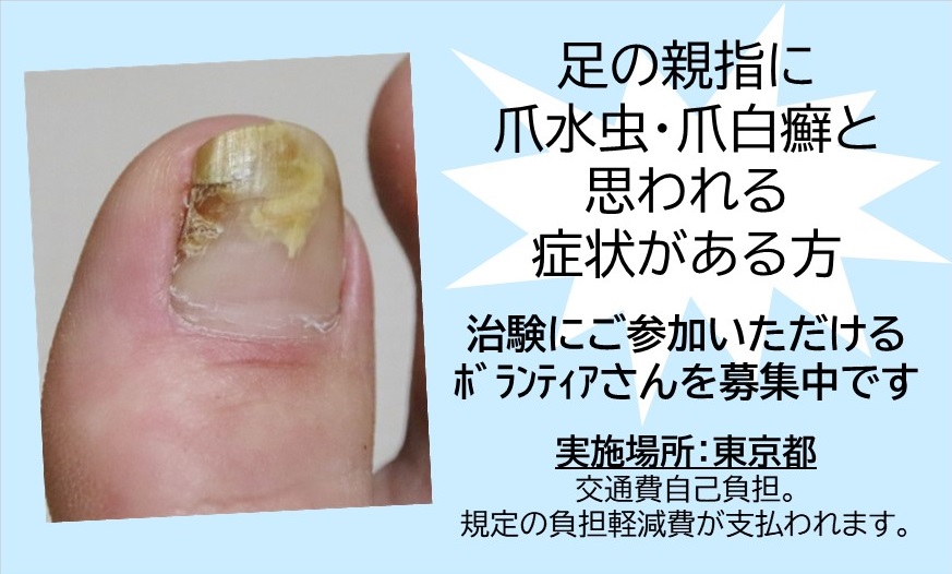 爪がでこぼこに 原因は 治し方は ネイルはできる 移動式ネイルサロン Serinail