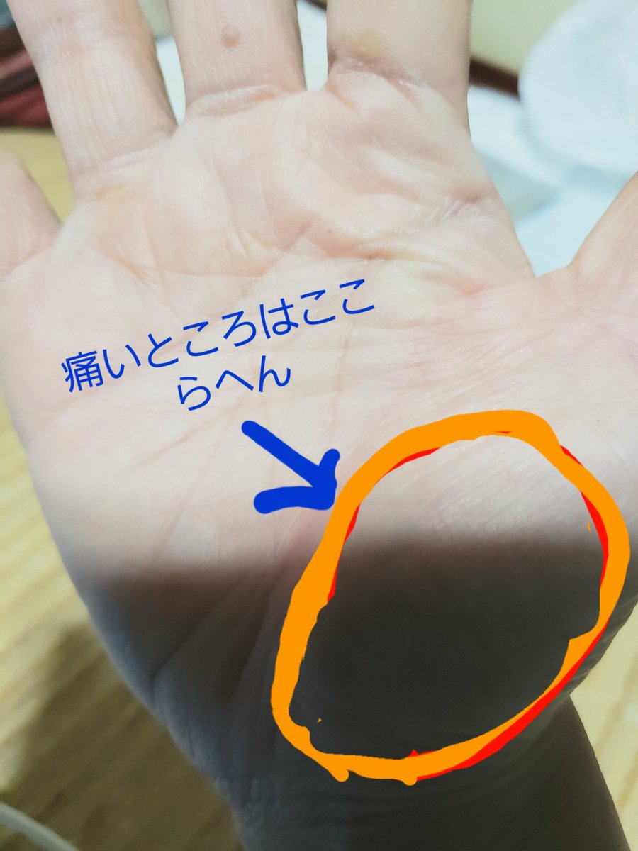 Fc関節用ソフト包帯 手のひら 手首用 ４００個セット １ケース分