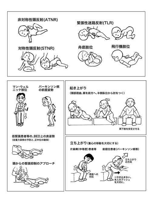 マン 肢位 重心 マン 肢位 重心